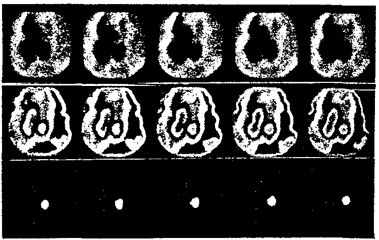 A-Set-of-gated-isotopic-ventriculography-images-taken-throughout-the-cardiac-cycle-B
